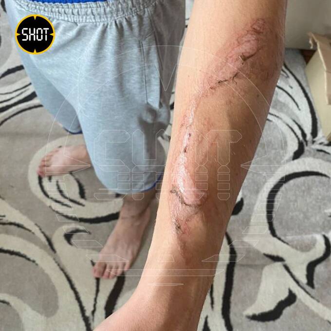 В Удмуртии в сауне во время вечеринки загорелась печка: есть пострадавшие